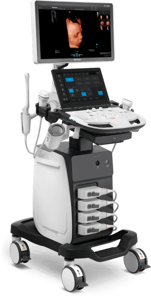 Interface utilisateur SonoScape P20 Elite