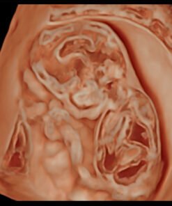 SonoScape P60 EXP pour cardiologie