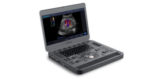 Échographe portable SonoScape X3 vue générale